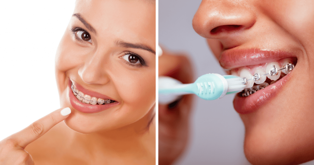 Ortodoncia Clínica Dental en Ciudad Real Dr Viso