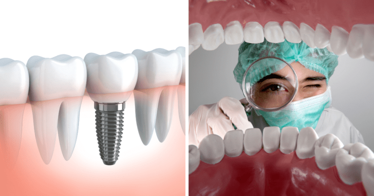 enfermedades periimplantarias