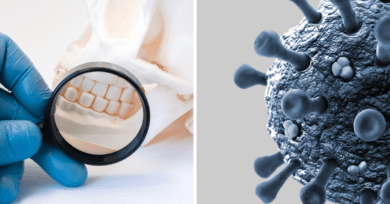 enfermedad de las encías y coronavirus
