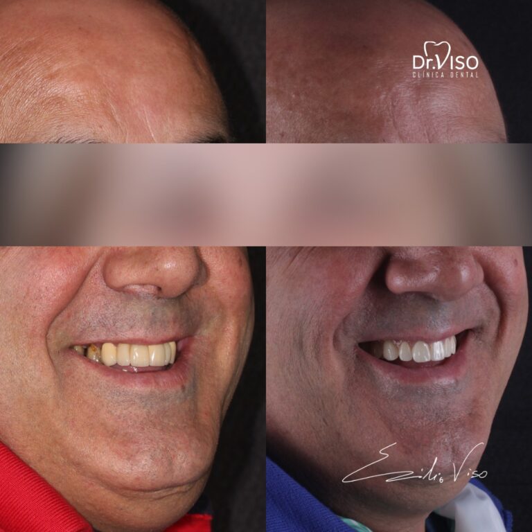 EUGENI~1
